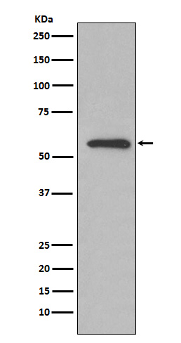 1 - Anti-Glucose 6 phosphate isomerase Rabbit Monoclonal Antibody ABO15281