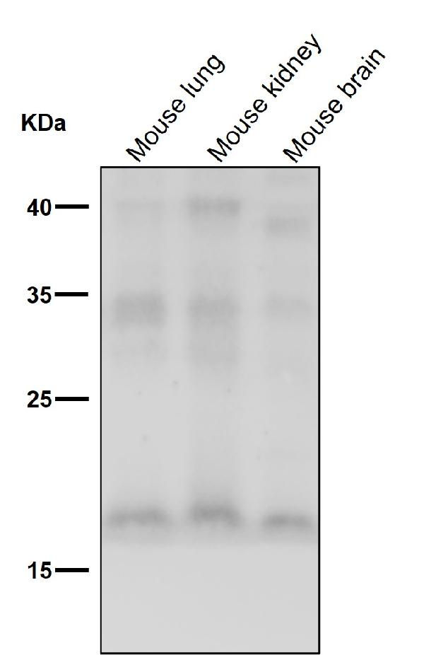 1 - Anti-FGF1 Rabbit Monoclonal Antibody ABO15282
