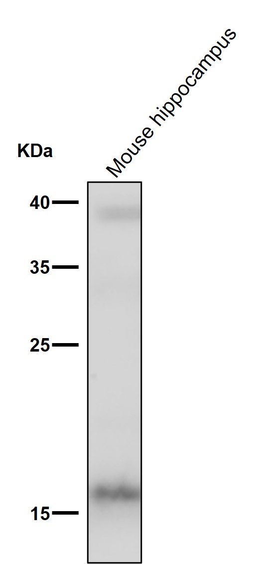 1 - Anti-FGF1 Rabbit Monoclonal Antibody ABO15282