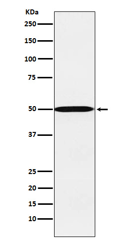 1 - Anti-CYP26A1 Rabbit Monoclonal Antibody ABO15283