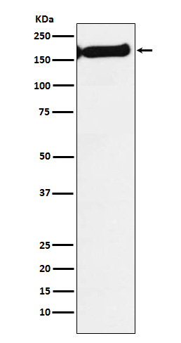 1 - Anti-SF3B1 Rabbit Monoclonal Antibody ABO15284