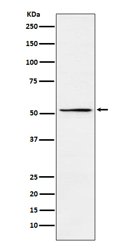 1 - Anti-MEIS2 Rabbit Monoclonal Antibody ABO15285