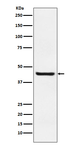 1 - Anti-Septin 2 Rabbit Monoclonal Antibody ABO15286