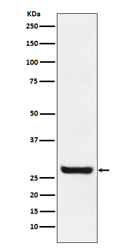 1 - Anti-Sprouty 4 Rabbit Monoclonal Antibody ABO15287