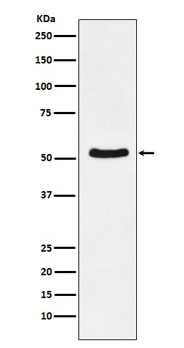 1 - Anti-DDX6 Rabbit Monoclonal Antibody ABO15288