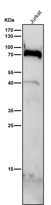 1 - Anti-GABA A Receptor alpha 5 Rabbit Monoclonal Antibody ABO15291