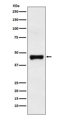 1 - Anti-LRG1 Rabbit Monoclonal Antibody ABO15293