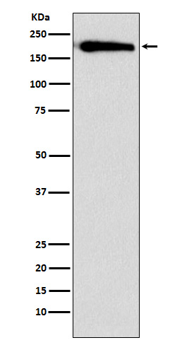 1 - Anti-SMARCC1/BAF155 Rabbit Monoclonal Antibody ABO15294