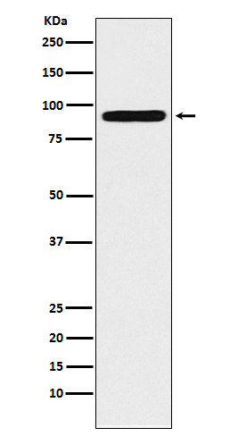 1 - Anti-ALDH1L1 Rabbit Monoclonal Antibody ABO15301
