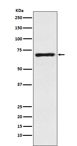 1 - Anti-SLC6A1 / GAT1 Rabbit Monoclonal Antibody ABO15304