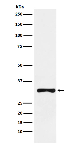 1 - Anti-RYBP Rabbit Monoclonal Antibody ABO15306