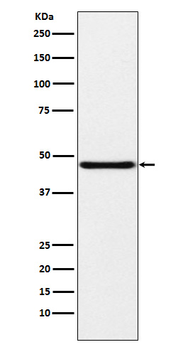 1 - Anti-NPHS2 Rabbit Monoclonal Antibody ABO15314