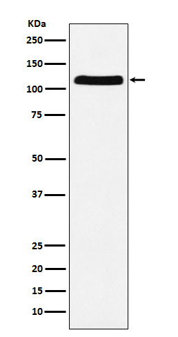 1 - Anti-E1 Ubiquitin Activating Enzyme Rabbit Monoclonal Antibody ABO15316