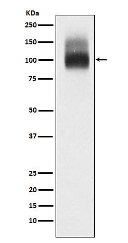 1 - Anti-SLC4A1/CD233/Band 3 Rabbit Monoclonal Antibody ABO15317