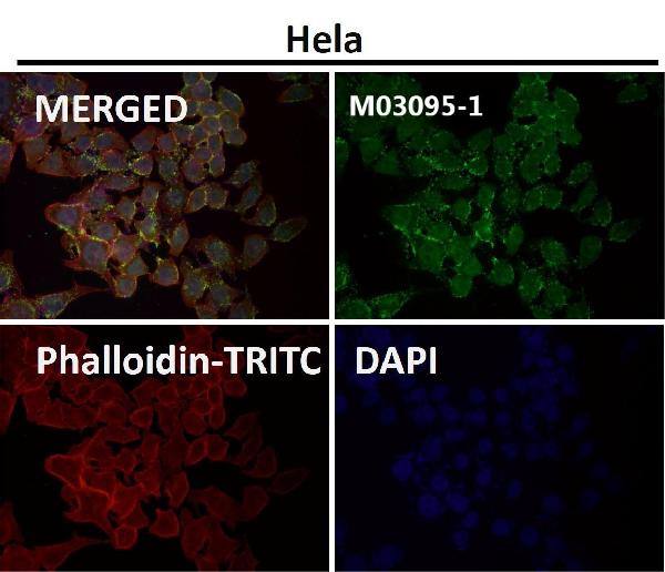 1 - Anti-eIF4A3 Rabbit Monoclonal Antibody ABO15318