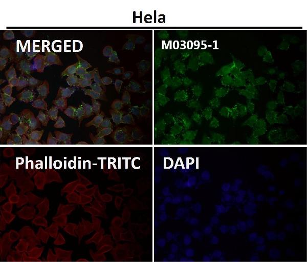1 - Anti-eIF4A3 Rabbit Monoclonal Antibody ABO15318