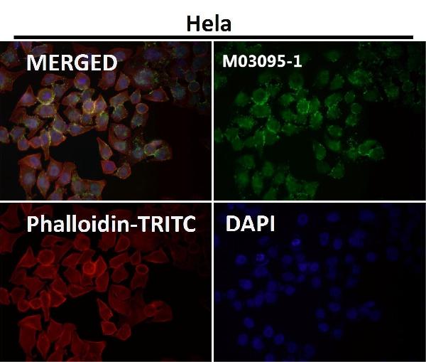 1 - Anti-eIF4A3 Rabbit Monoclonal Antibody ABO15318