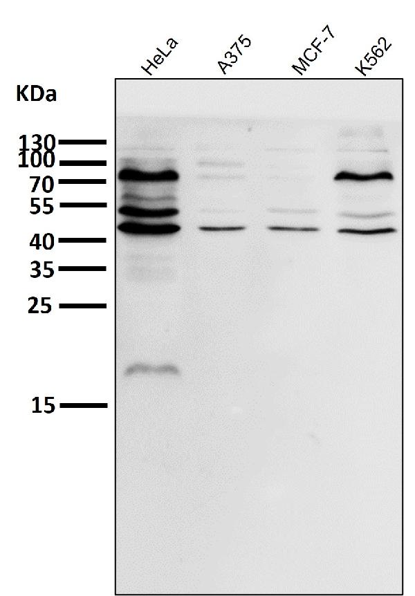 1 - Anti-eIF4A3 Rabbit Monoclonal Antibody ABO15318
