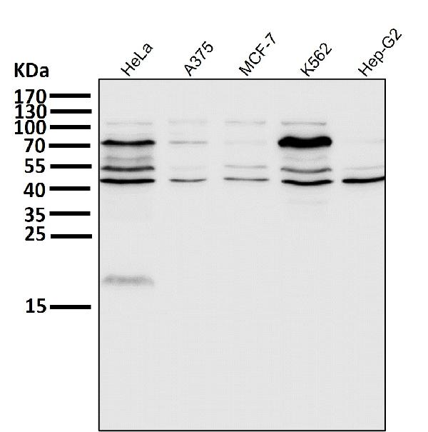 1 - Anti-eIF4A3 Rabbit Monoclonal Antibody ABO15318