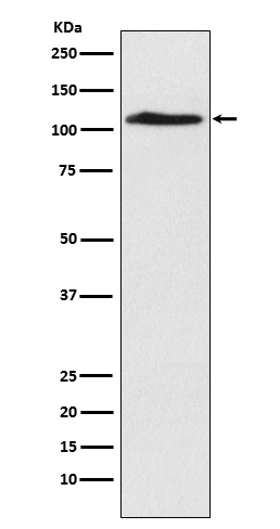 1 - Anti-CHD1L Rabbit Monoclonal Antibody ABO15320