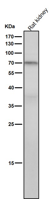 1 - Anti-PKC theta Rabbit Monoclonal Antibody ABO15323