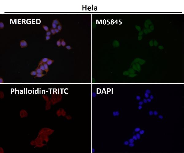 1 - Anti-P70 S6 Kinase beta Rabbit Monoclonal Antibody ABO15324