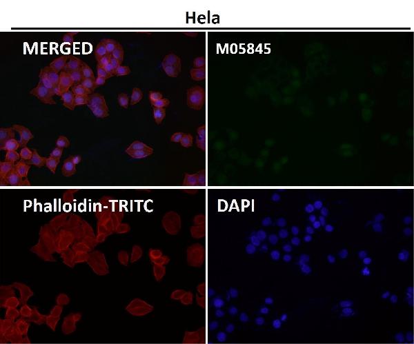 1 - Anti-P70 S6 Kinase beta Rabbit Monoclonal Antibody ABO15324