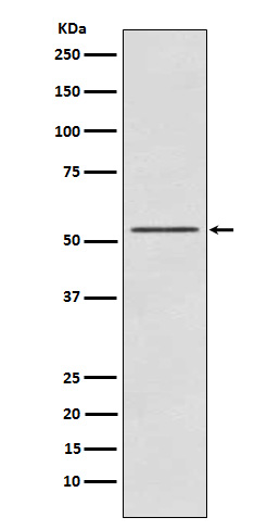 1 - Anti-P70 S6 Kinase beta Rabbit Monoclonal Antibody ABO15324