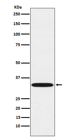 1 - Anti-TREX1 Rabbit Monoclonal Antibody ABO15326