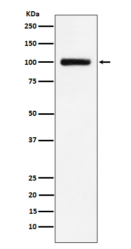 1 - Anti-Transferrin Receptor 2 Rabbit Monoclonal Antibody ABO15331