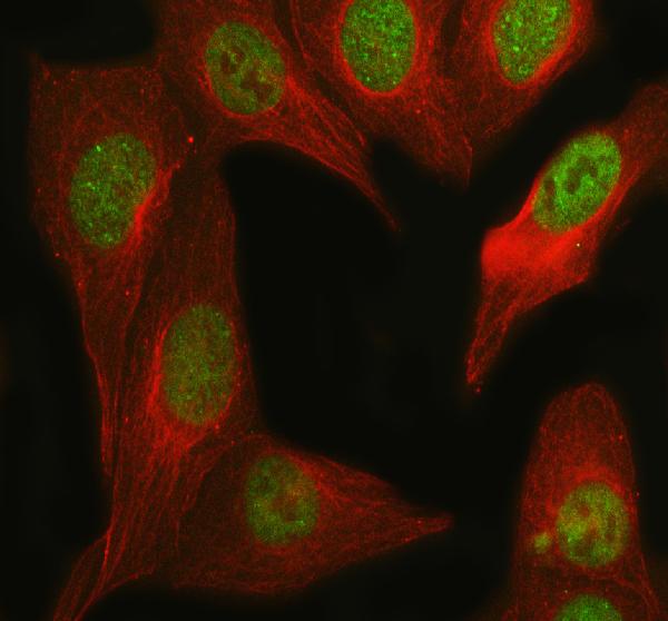 3 - Anti-KAT8 / MYST1 / MOF Rabbit Monoclonal Antibody ABO15334