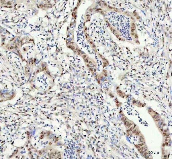 2 - Anti-KAT8 / MYST1 / MOF Rabbit Monoclonal Antibody ABO15334