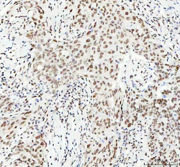 2 - Anti-KAT8 / MYST1 / MOF Rabbit Monoclonal Antibody ABO15334