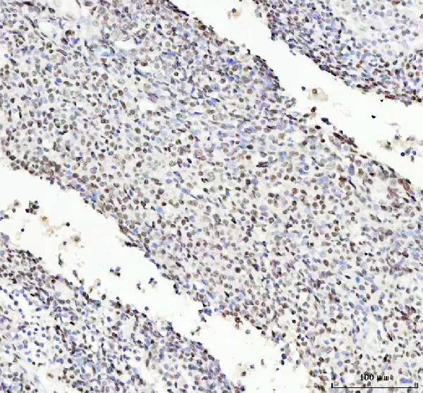 2 - Anti-KAT8 / MYST1 / MOF Rabbit Monoclonal Antibody ABO15334