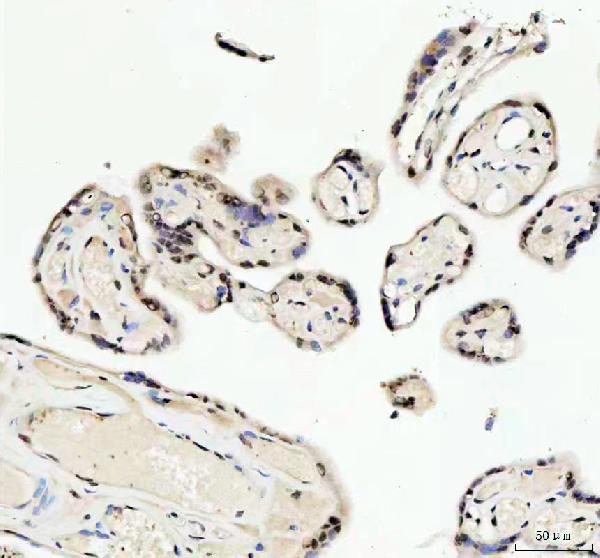 2 - Anti-KAT8 / MYST1 / MOF Rabbit Monoclonal Antibody ABO15334