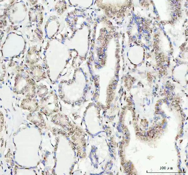 2 - Anti-KAT8 / MYST1 / MOF Rabbit Monoclonal Antibody ABO15334