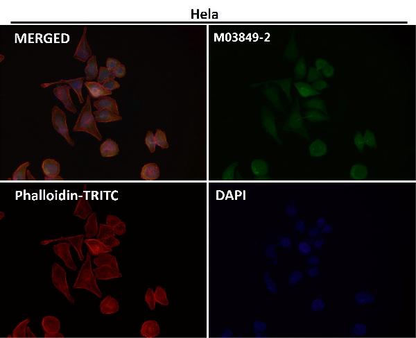 1 - Anti-Destrin Rabbit Monoclonal Antibody ABO15335