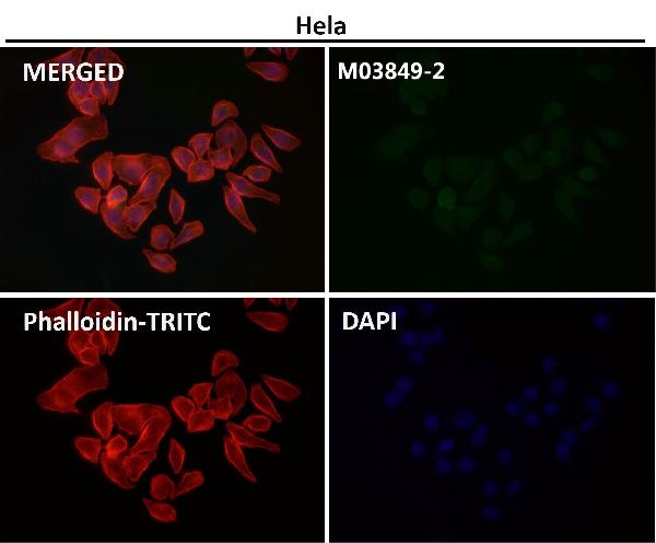 1 - Anti-Destrin Rabbit Monoclonal Antibody ABO15335