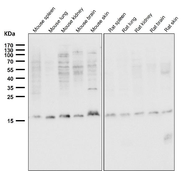 1 - Anti-Destrin Rabbit Monoclonal Antibody ABO15335