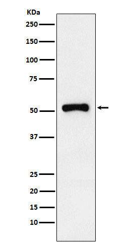 1 - Anti-Retinoic Acid Receptor gamma Rabbit Monoclonal Antibody ABO15336