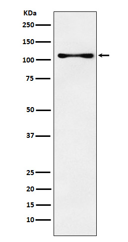 1 - Anti-CENPC Rabbit Monoclonal Antibody ABO15337