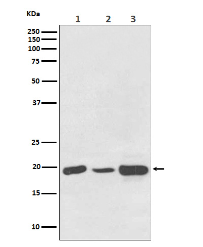 1 - Anti-NDUFB8 Rabbit Monoclonal Antibody ABO15338
