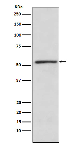 1 - Anti-TBLR1 Rabbit Monoclonal Antibody ABO15340