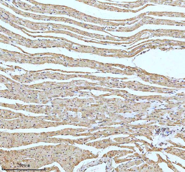 2 - Anti-UQCRFS1 Rabbit Monoclonal Antibody ABO15342