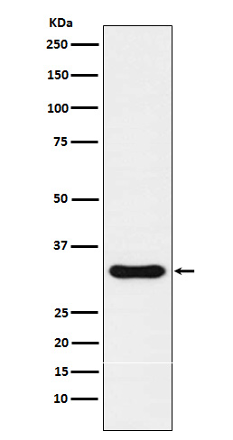1 - Anti-NKX3.1 Rabbit Monoclonal Antibody ABO15345
