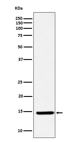 1 - Anti-CDKN2A/p14ARF Rabbit Monoclonal Antibody ABO15350