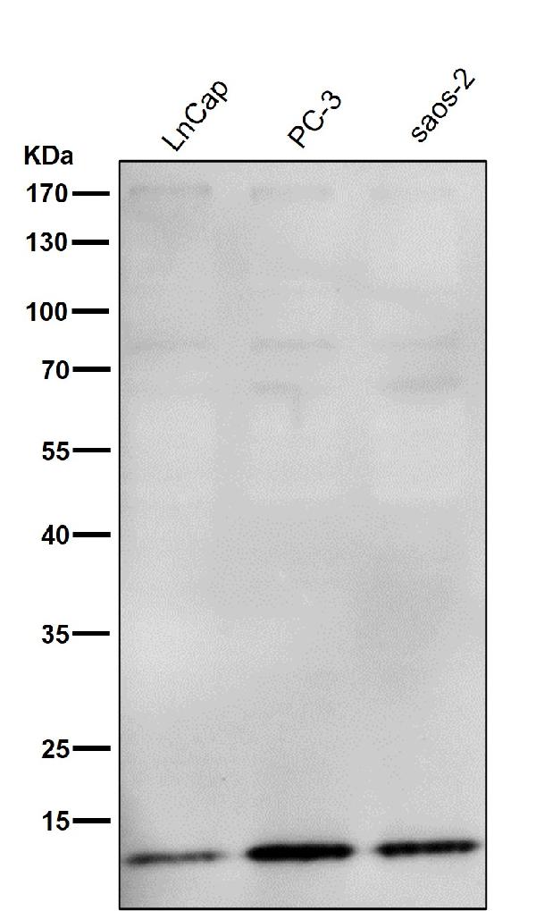1 - Anti-CDKN2A/p14ARF Rabbit Monoclonal Antibody ABO15350