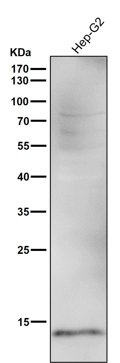 1 - Anti-CDKN2A/p14ARF Rabbit Monoclonal Antibody ABO15350