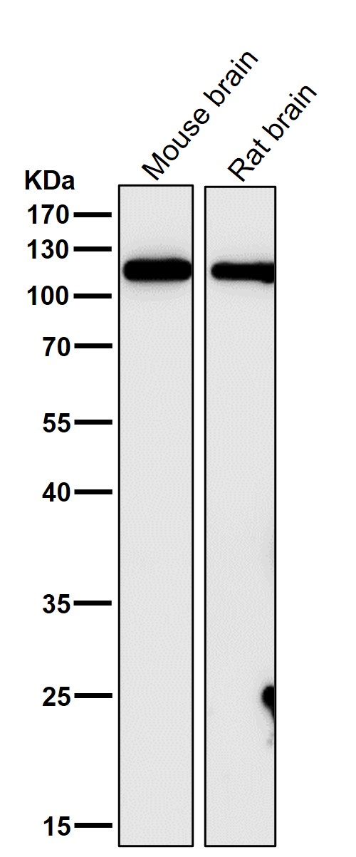 1 - Anti-GEF H1 Rabbit Monoclonal Antibody ABO15351