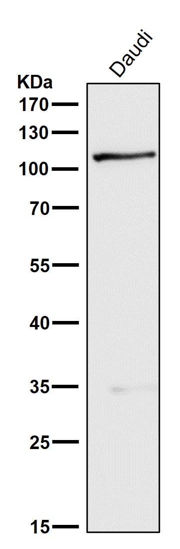 1 - Anti-GEF H1 Rabbit Monoclonal Antibody ABO15351